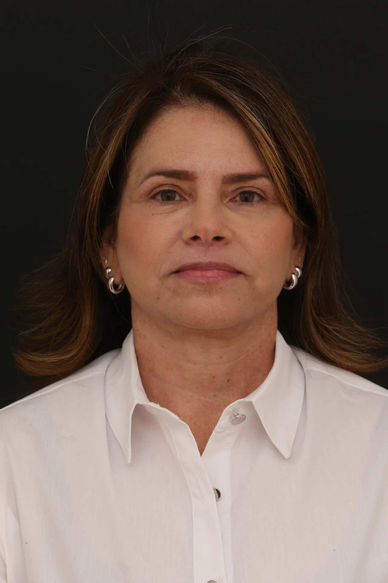 Depois, caso 4, vista frontal